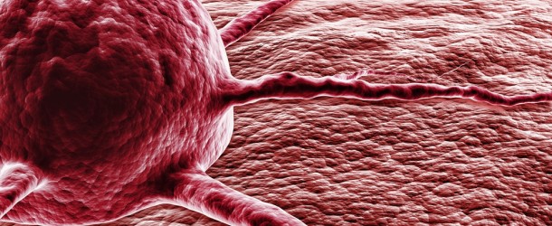 Los microbios en el intestino ayudan a determinar el RIESGO DE TUMORES